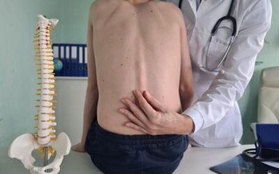 What Immediate Actions Can Prevent Mobility Loss After a Spinal Injury?