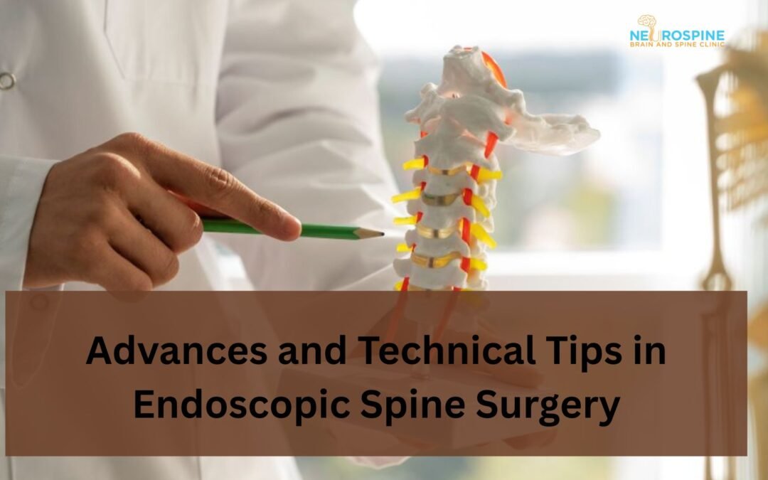 Advances and Technical Tips in Endoscopic Spine Surgery